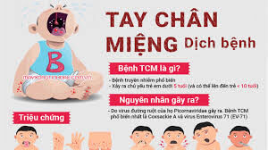 BỆNH TAY CHÂN MIỆNG VÀ CÁCH PHÒNG CHỐNG